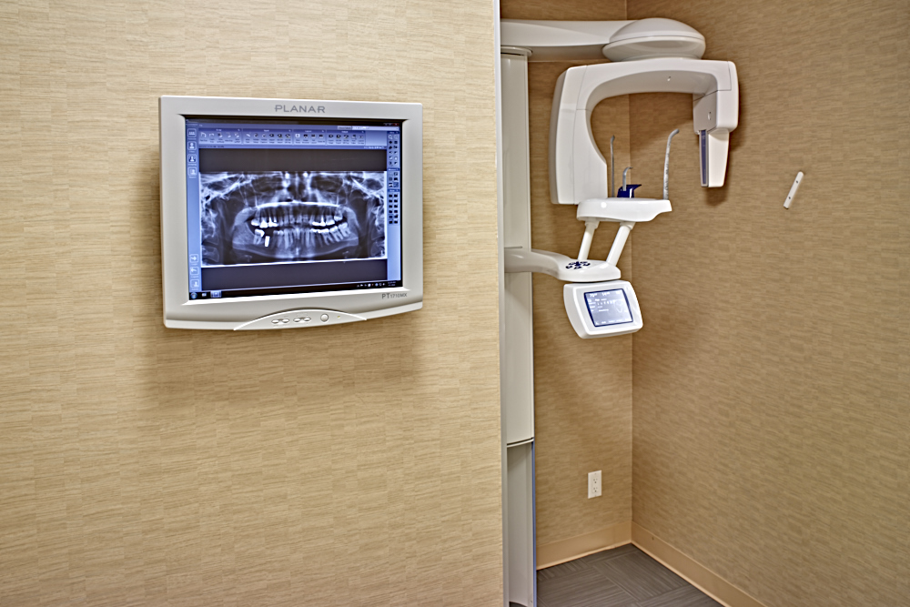 Image of 3D Scanner